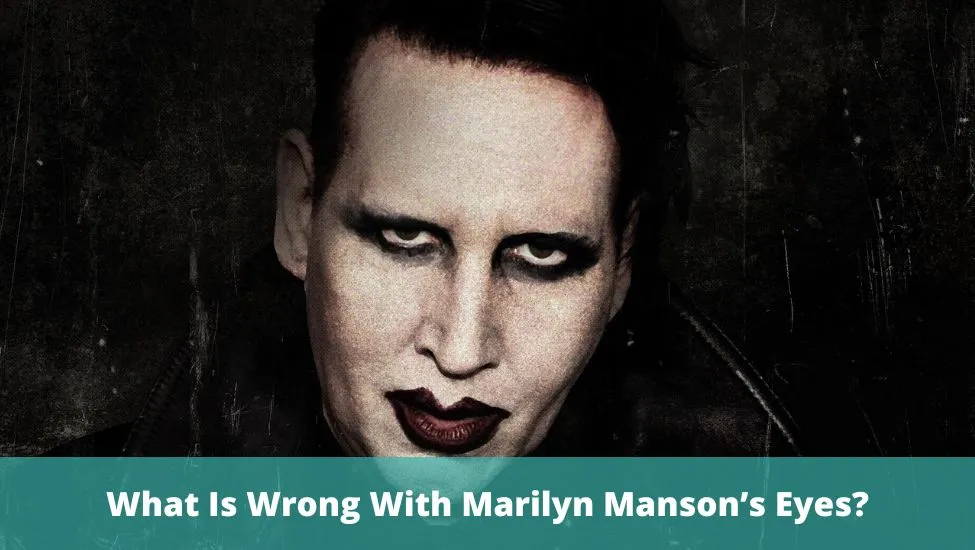 What Is Wrong With Marilyn Manson’s Eyes?