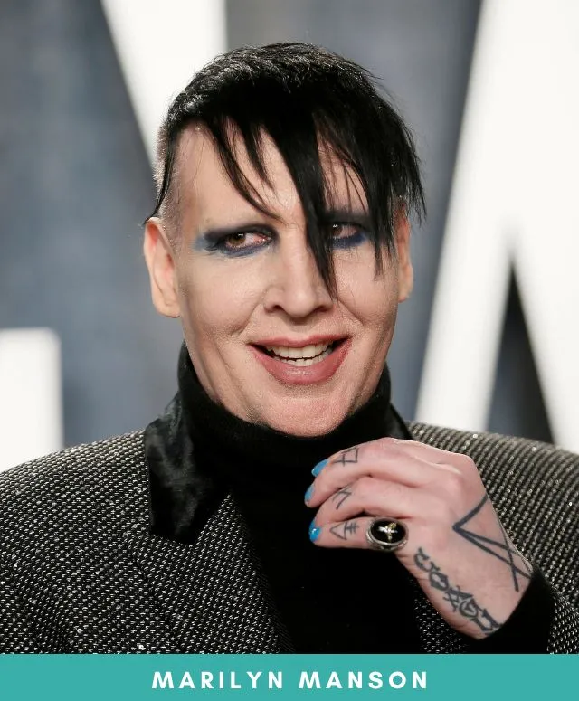 What is wrong with Marilyn Manson’s eyes