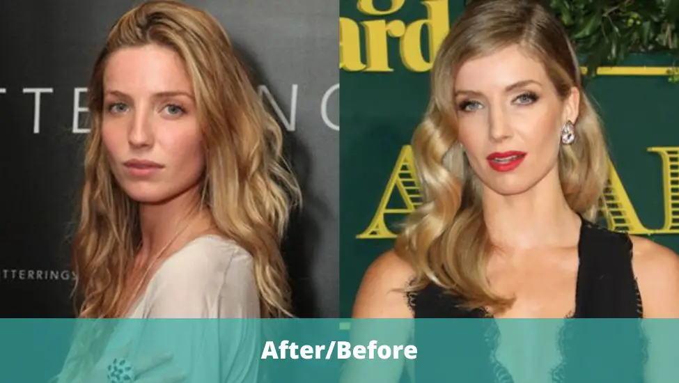 Annabelle Wallis Nose Job See The Before And After Pics 