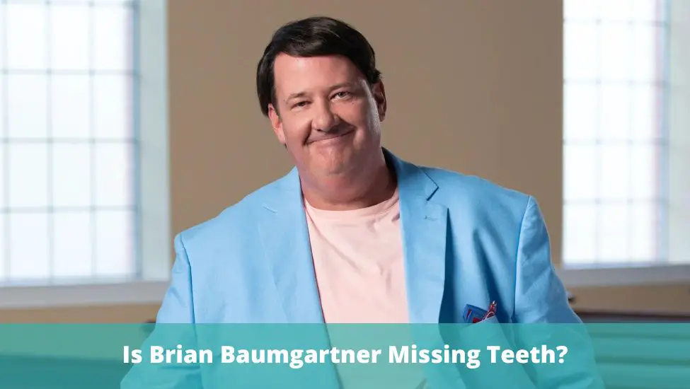 Is Brian Baumgartner Missing Teeth?