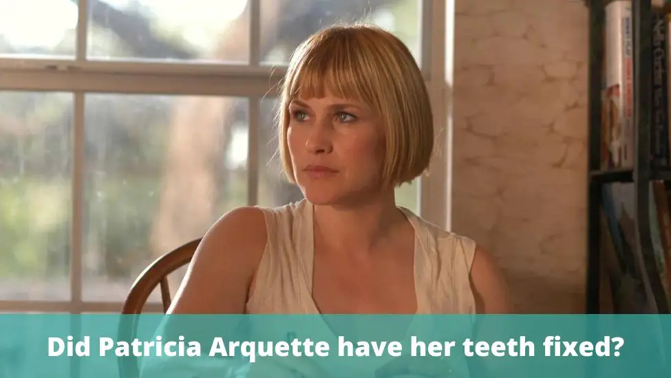 Did Patricia Arquette have her teeth fixed?